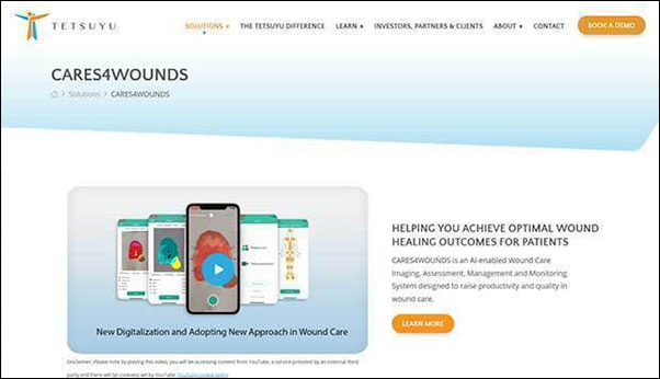 テツユウ・ヘルスケアは褥瘡マネジメントのクラウドサービスを提供している（公式ホームページのサービス紹介ページをスクリーンショット）