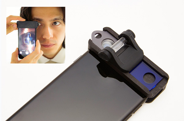 ウイインクが開発した眼科医療機器「スマート・アイ・カメラ」はｉＰｈｏｎｅに取り付けて使用する（同社提供）