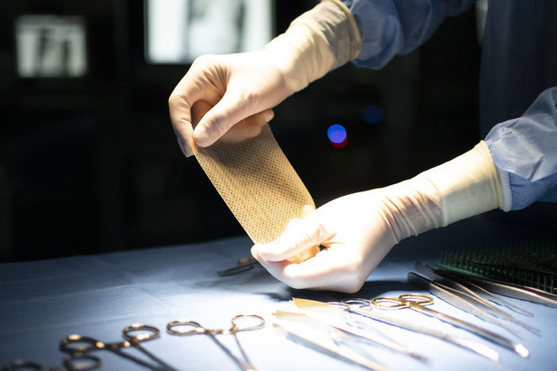 帝人がインド展開を検討する心・血管修復パッチ「シンフォリウム」（帝人提供）